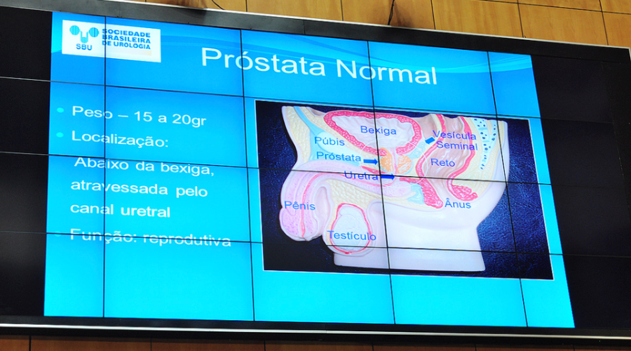 Prostata_Urologen_Brasilien