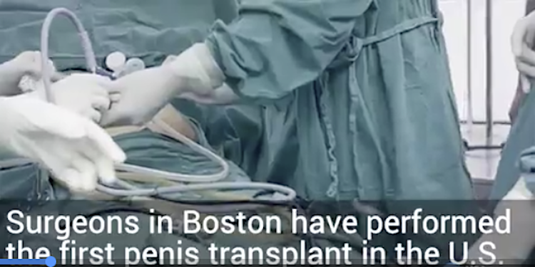 Penis-Transplantation.USA Today