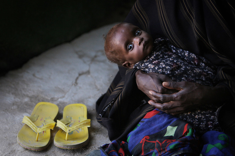 Unterernährtes Baby Somalia