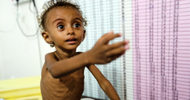 Jemen.Untereränährtes Kind.PBS.org