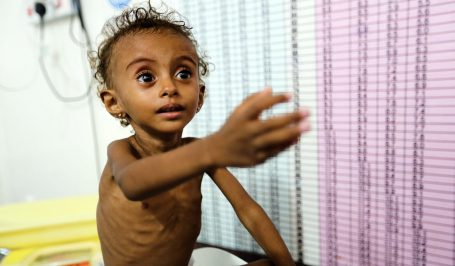 Jemen.Untereränährtes Kind.PBS.org
