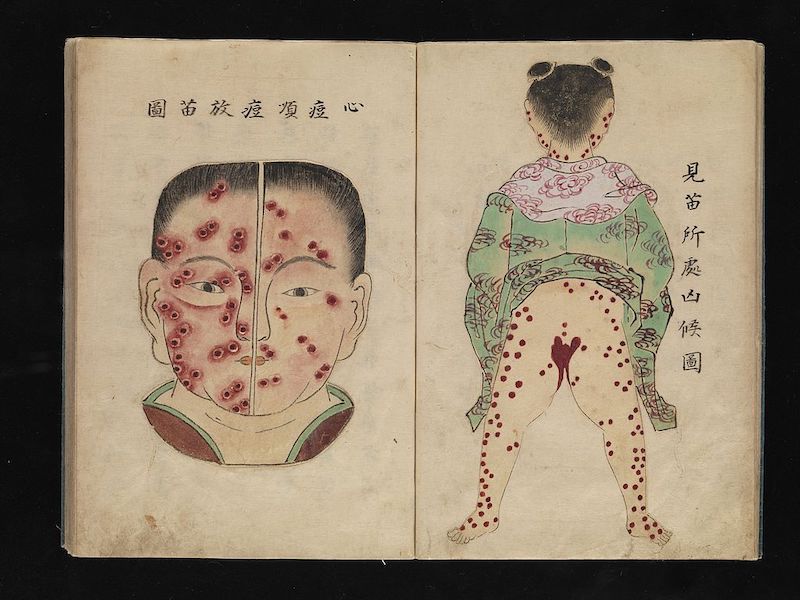 Pocken Illustration Japan, 1720