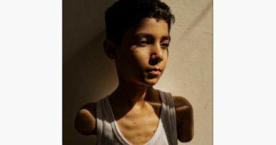 Bei einem israelischen Luftangriff verlor dieser 9-Jährige beide Arme. Das Bild wurde 2025 zum World Press Photo. Unterdessen lebt der Bub mit Prothesen in Katar.
