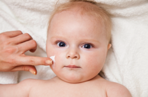 Neurodermitis: Tägliches Eincremen beugte bei Babys vor
