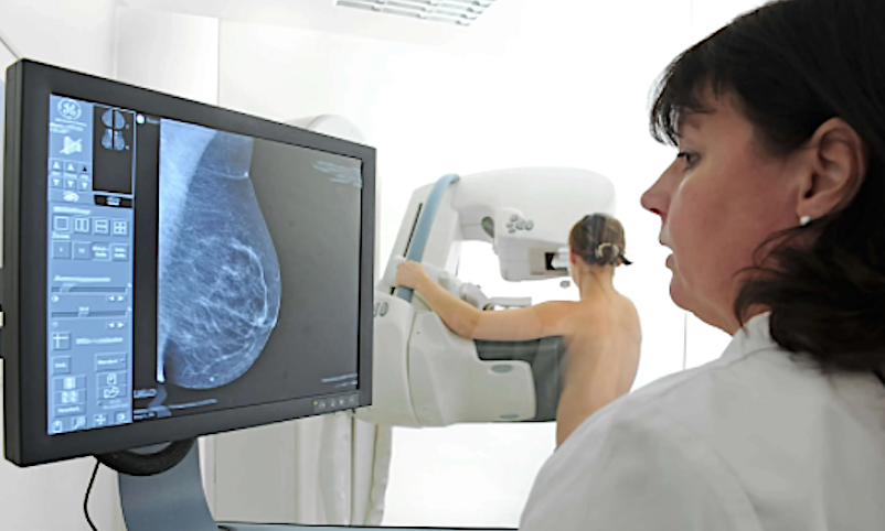Brustkrebs-Screening-Frauen-werden-seit-Jahrzehnten-betrogen