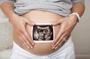 Schwangere mit Ultraschallbild