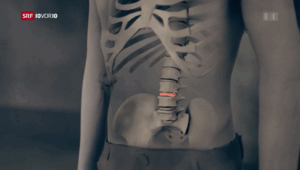 Anwältin von Chirurg Max Aebi fordert über 900'000 Franken