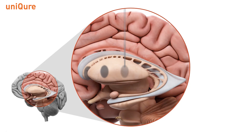 Bildschirmfoto 2026-04-17 um 18.13.16